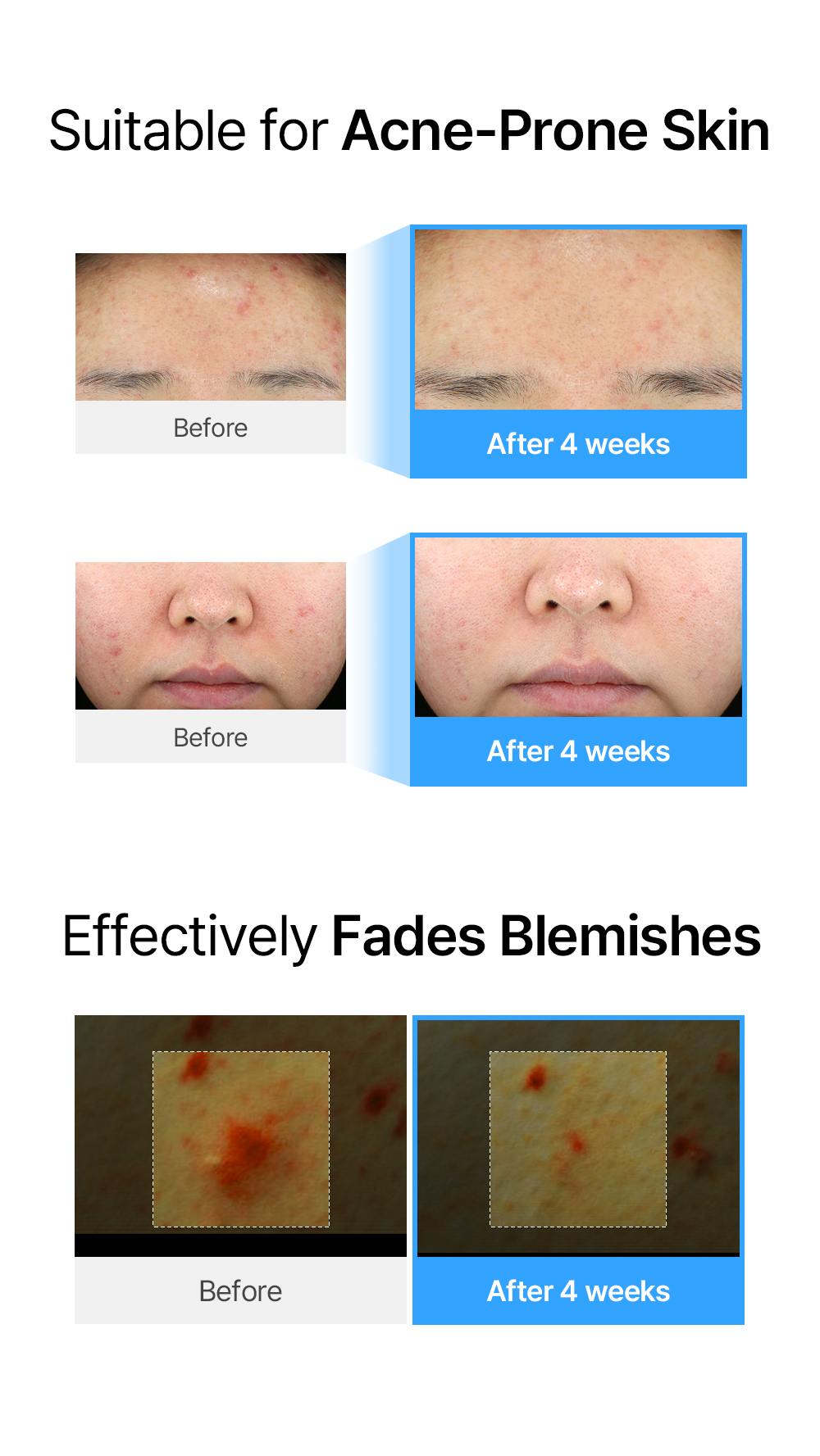 Blue AC Calming Serum