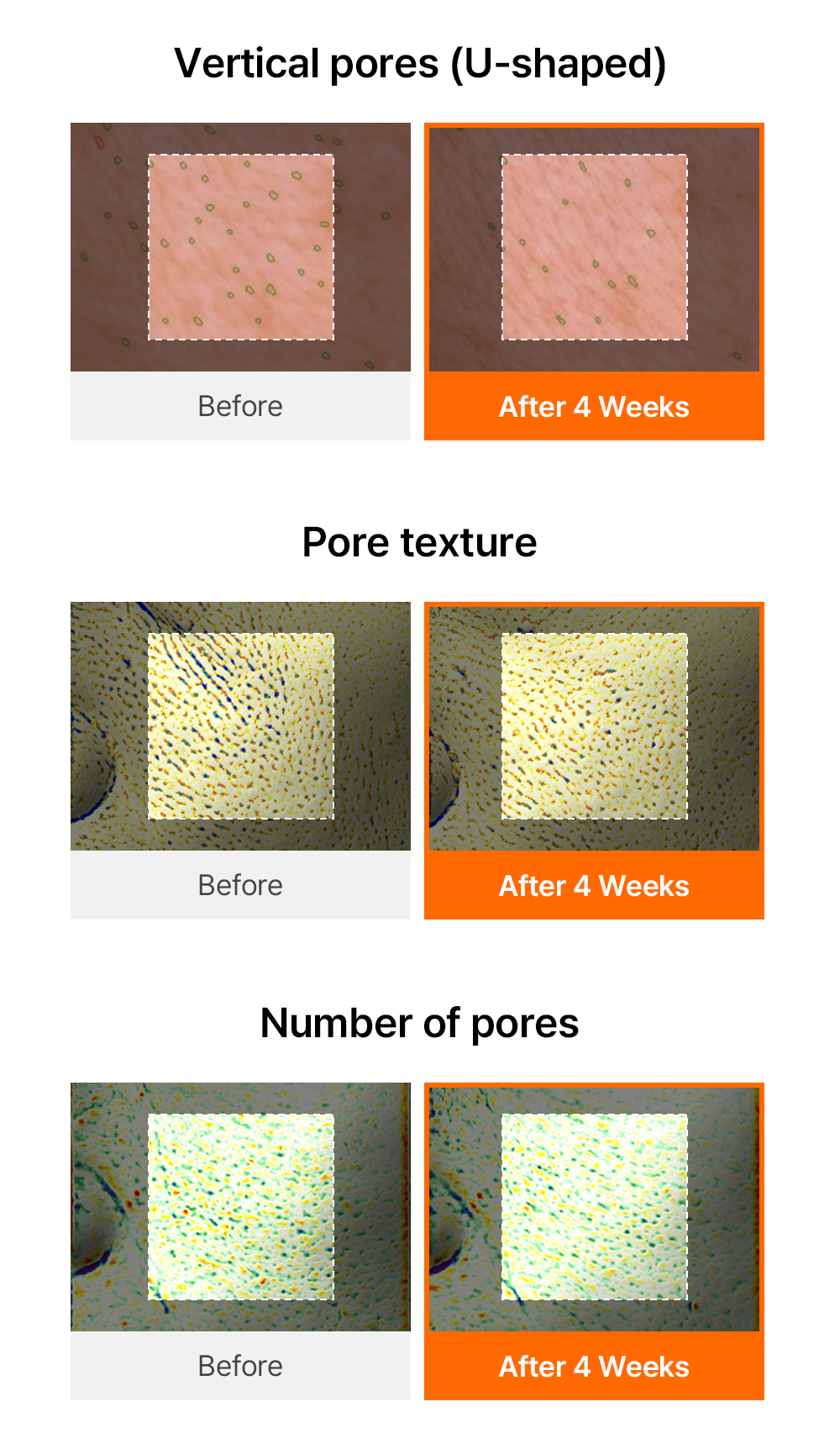 Vitamin PDRN Bouncy Pore Serum