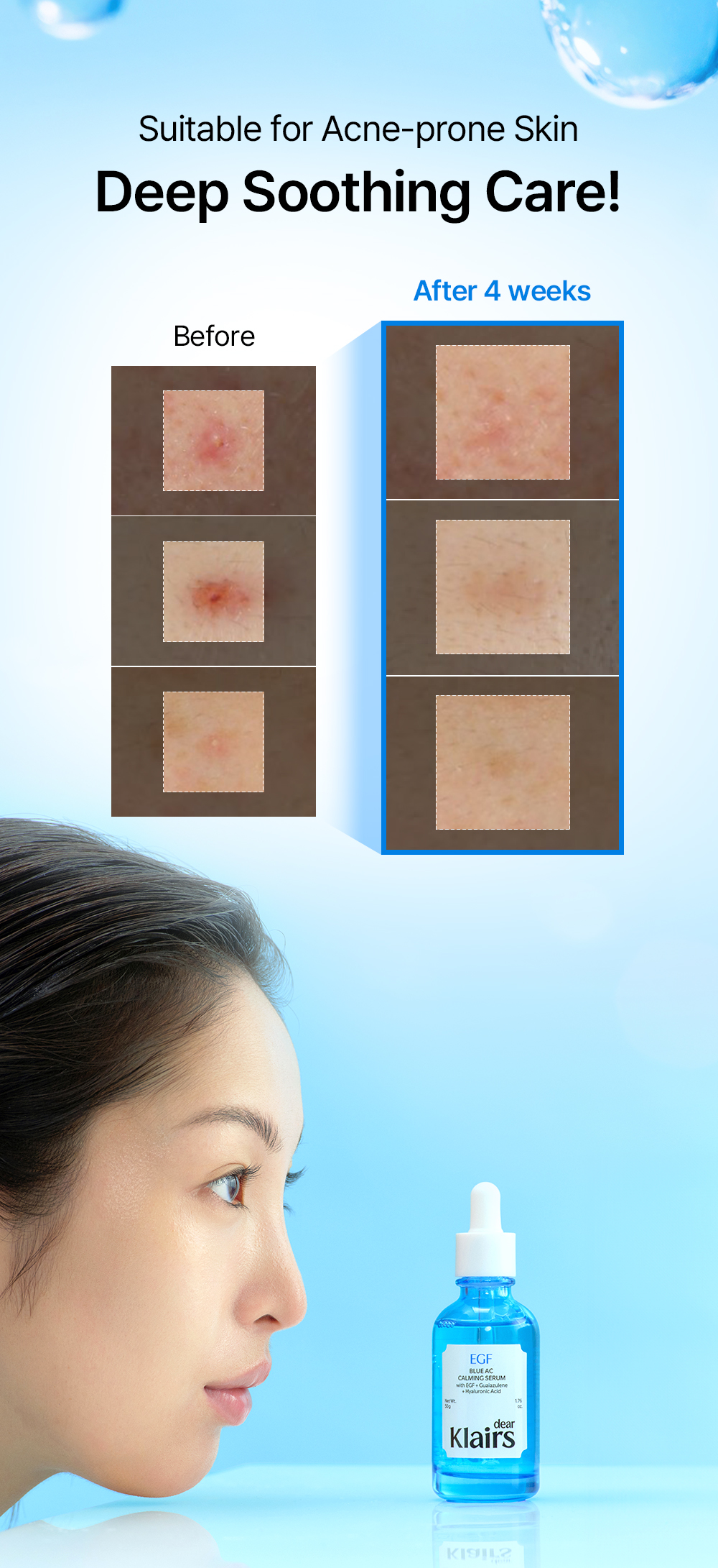 Blue AC Calming Serum